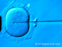 Kinderwunsch In-vitro-Fertilisierung